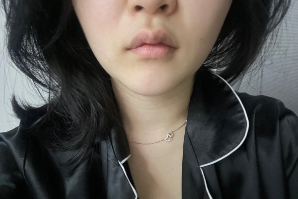 이중턱 발살냈어요!