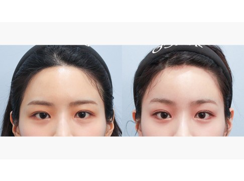 이마거상