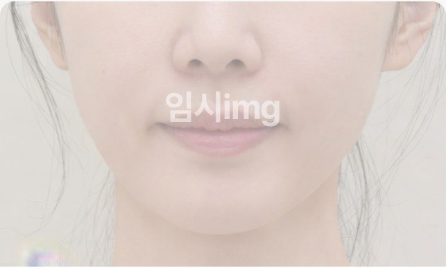 목거상술 전 목 중앙 세로주름