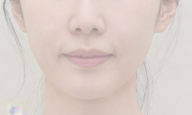 수술 전 예시 2